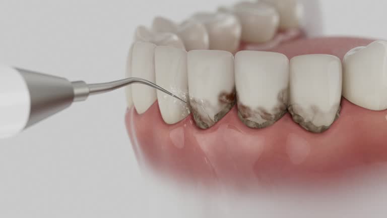 Reliable Tooth Extraction contractor in Campbell County County, TN by Dentist Open Now